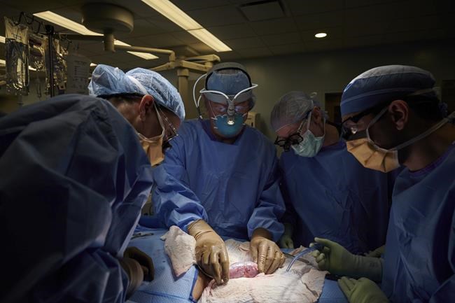 In this September 2021 photo provided by NYU Langone Health, a surgical team at the hospital in New York examines a pig kidney attached to the body of a deceased recipient for any signs of rejection. From left are Drs. Zoe A. Stewart-Lewis, Robert A. Montgomery, Bonnie E. Lonze and Jeffrey Stern. The test was a step in the decades-long quest to one day use animal organs for life-saving transplants. (Joe Carrotta/NYU Langone Health via AP)