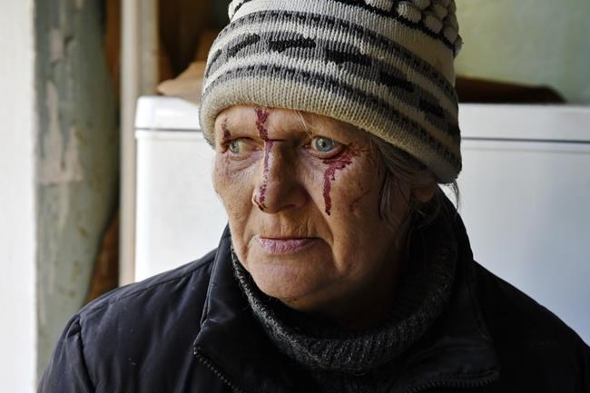 Injured Natalia Rudneva, 59, reacts as her son was hospitalised after night shelling in Kramatorsk, Ukraine, Thursday, May 5, 2022.(AP Photo/Andriy Andriyenko)